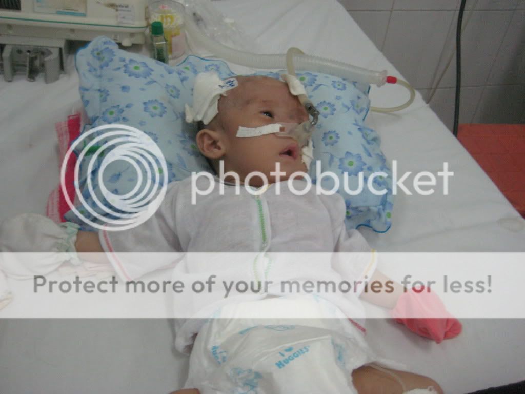 Cứu bé Khánh Hùng 2 tháng tuổi cần 65tr mổ tim gấp vào 30/6