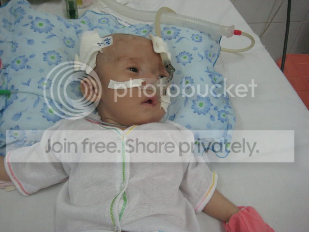 Cứu bé Khánh Hùng 2 tháng tuổi cần 65tr mổ tim gấp vào 30/6 - 1