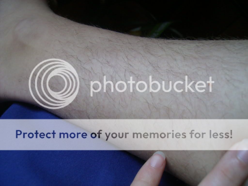 How do you get rid of hairy legs? (pic) BabyGaga